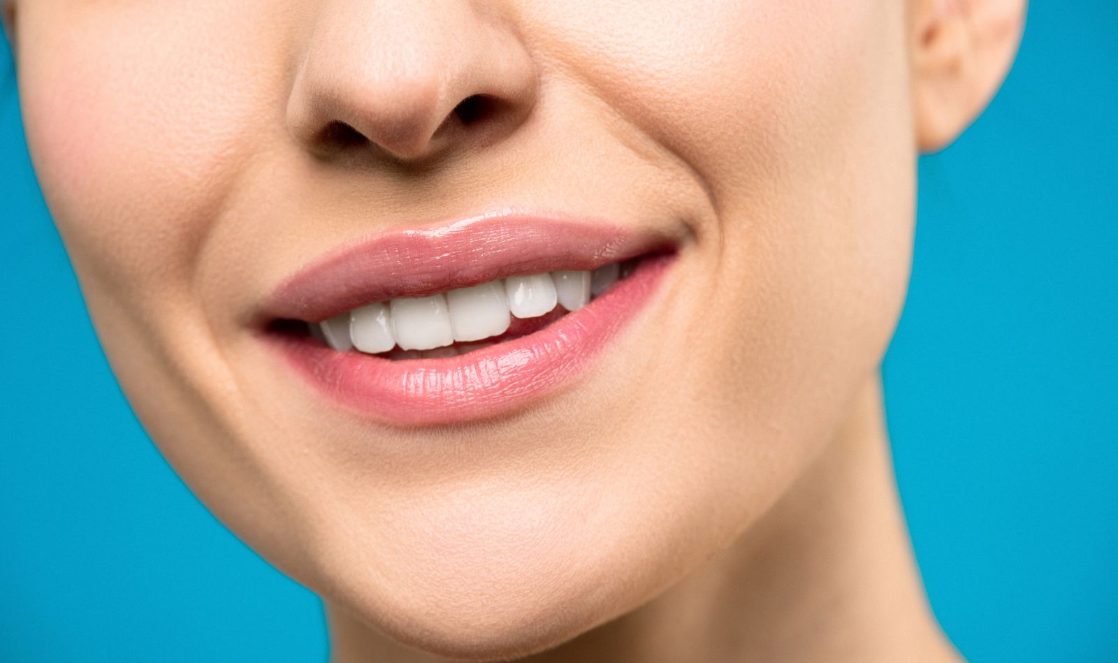 Before: whitening and six porcelain veneers (sample image)