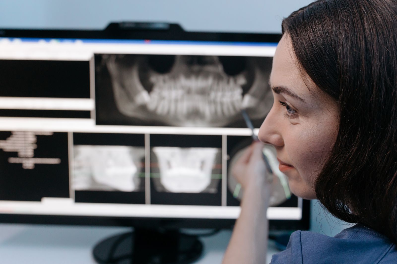 3D CBCT imaging